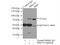 Protein Kinase C Delta antibody, 19132-1-AP, Proteintech Group, Immunoprecipitation image 