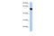 Amyloid Beta Precursor Protein Binding Family A Member 3 antibody, 27-226, ProSci, Western Blot image 