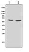 Cytochrome B-245 Beta Chain antibody, GTX12024, GeneTex, Western Blot image 
