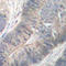 Eukaryotic Translation Initiation Factor 2 Alpha Kinase 2 antibody, LS-C335981, Lifespan Biosciences, Immunohistochemistry frozen image 