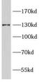 Endoplasmic Reticulum To Nucleus Signaling 1 antibody, FNab10300, FineTest, Western Blot image 