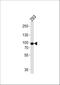 Phospholipase A2 Group IVA antibody, A00854-1, Boster Biological Technology, Western Blot image 