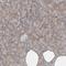 DEP Domain Containing MTOR Interacting Protein antibody, NBP1-85256, Novus Biologicals, Immunohistochemistry paraffin image 