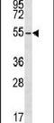 Protein Kinase CAMP-Dependent Type II Regulatory Subunit Beta antibody, PA5-13799, Invitrogen Antibodies, Western Blot image 