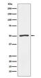 Proteasome 26S Subunit, Non-ATPase 4 antibody, M03544-1, Boster Biological Technology, Western Blot image 