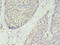 Transmembrane Protein 45A antibody, LS-C376859, Lifespan Biosciences, Immunohistochemistry paraffin image 