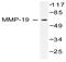 Matrix Metallopeptidase 19 antibody, AP06230PU-N, Origene, Western Blot image 