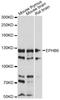 EPH Receptor B6 antibody, LS-C749711, Lifespan Biosciences, Western Blot image 