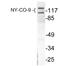 Histone Deacetylase 5 antibody, LS-C176058, Lifespan Biosciences, Western Blot image 
