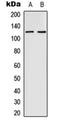 EPH Receptor B4 antibody, orb216101, Biorbyt, Western Blot image 