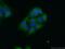 SS-A antibody, 12108-1-AP, Proteintech Group, Immunofluorescence image 