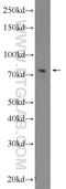 ADAM Metallopeptidase Domain 17 antibody, 24620-1-AP, Proteintech Group, Western Blot image 