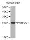 Phosphoribosyl Transferase Domain Containing 1 antibody, LS-C333657, Lifespan Biosciences, Western Blot image 