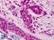 Docking Protein 1 antibody, LS-B561, Lifespan Biosciences, Immunohistochemistry paraffin image 