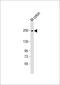 Myosin Heavy Chain 11 antibody, MBS9216655, MyBioSource, Western Blot image 
