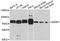 SUMO Specific Peptidase 1 antibody, A13086, ABclonal Technology, Western Blot image 