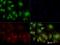Glia Maturation Factor Gamma antibody, NBP2-31367, Novus Biologicals, Immunofluorescence image 