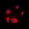 Ribosomal Protein S6 Kinase B1 antibody, orb315696, Biorbyt, Immunofluorescence image 