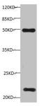 TIMP Metallopeptidase Inhibitor 1 antibody, LS-C285818, Lifespan Biosciences, Western Blot image 