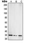 Toll Interacting Protein antibody, orb215200, Biorbyt, Western Blot image 