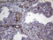 TRNA Methyltransferase 12 Homolog antibody, M15532-1, Boster Biological Technology, Immunohistochemistry paraffin image 