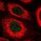 TOX High Mobility Group Box Family Member 2 antibody, NBP2-13464, Novus Biologicals, Immunocytochemistry image 