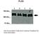 Phospholipase D2 antibody, 25-111, ProSci, Western Blot image 