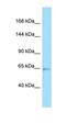 Unc-5 Netrin Receptor C antibody, orb331271, Biorbyt, Western Blot image 