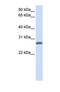 Transmembrane Protein 51 antibody, NBP1-69597, Novus Biologicals, Western Blot image 