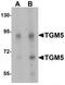 Transglutaminase 5 antibody, TA319777, Origene, Western Blot image 