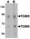 Transglutaminase-5 antibody, TA319777, Origene, Western Blot image 