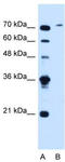 GST antibody, TA334614, Origene, Western Blot image 