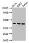 PHD Finger Protein 6 antibody, CSB-PA017917LA01HU, Cusabio, Western Blot image 