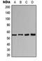 Cholinergic Receptor Nicotinic Alpha 1 Subunit antibody, orb216059, Biorbyt, Western Blot image 