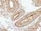 Eukaryotic Translation Initiation Factor 2B Subunit Beta antibody, PA5-22295, Invitrogen Antibodies, Immunohistochemistry frozen image 