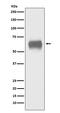CD5 Molecule antibody, M00480-1, Boster Biological Technology, Western Blot image 