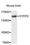 Cytoplasmic FMR1 Interacting Protein 2 antibody, STJ23309, St John