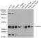 Proteasome Subunit Alpha 5 antibody, GTX32817, GeneTex, Western Blot image 