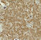 Ta antibody, 8045, ProSci, Immunohistochemistry paraffin image 