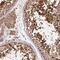 Katanin Catalytic Subunit A1 Like 2 antibody, PA5-59830, Invitrogen Antibodies, Immunohistochemistry frozen image 