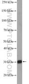 Peroxisomal Biogenesis Factor 26 antibody, 27472-1-AP, Proteintech Group, Western Blot image 