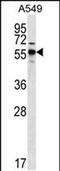 Sphingolipid Transporter 3 (Putative) antibody, PA5-48420, Invitrogen Antibodies, Western Blot image 