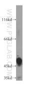 Homogentisate 1,2-Dioxygenase antibody, 16465-1-AP, Proteintech Group, Western Blot image 