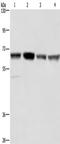 Glyoxylate Reductase 1 Homolog antibody, TA351224, Origene, Western Blot image 