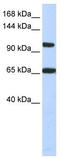 Thyroid Hormone Receptor Associated Protein 3 antibody, TA343506, Origene, Western Blot image 