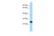 Sodium Channel Modifier 1 antibody, PA5-45736, Invitrogen Antibodies, Western Blot image 