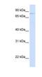 Olfactomedin Like 2B antibody, NBP1-59547, Novus Biologicals, Western Blot image 