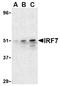 Interferon Regulatory Factor 7 antibody, AP05221PU-N, Origene, Western Blot image 