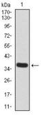 Lysine Demethylase 5B antibody, NBP2-52500, Novus Biologicals, Western Blot image 