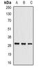 Ubiquitin Conjugating Enzyme E2 J2 antibody, orb341274, Biorbyt, Western Blot image 